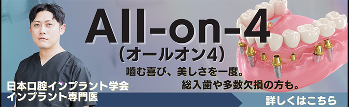 オールオン4